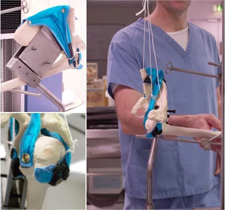 Montagem de close-up de acessórios de teste de prótese da articulação do ombro